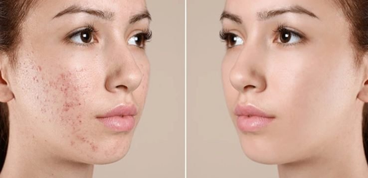 Dermatology Department