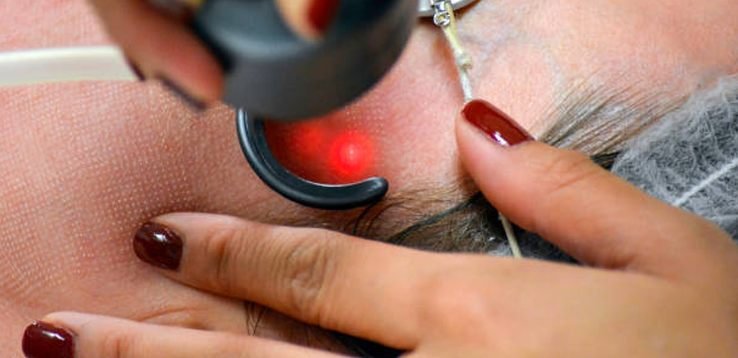 Laser Treatments Department